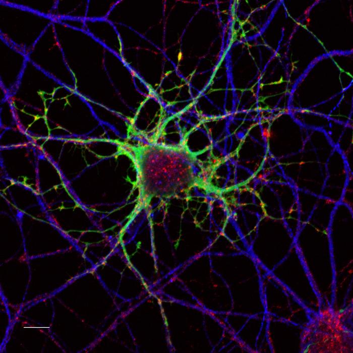 Forscher beobachteten eine verringerte Dichte von Nervenzellen in der Knochenhaut von Mäusen, die mit fettreicher Nahrung gefüttert wurden. ©  Studie