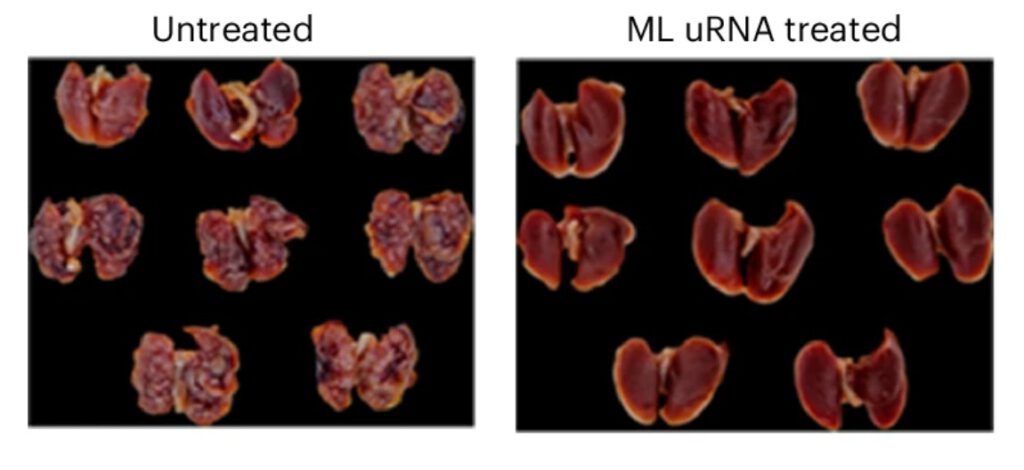 Nach der mRNA-Impfung zeigen die Lungen deutlich weniger Tumorknoten (rechts): Das Bild aus der Studie veranschaulicht, wie stark die Immunreaktion das Krebswachstum bremsen kann. © nature biomedical engineering