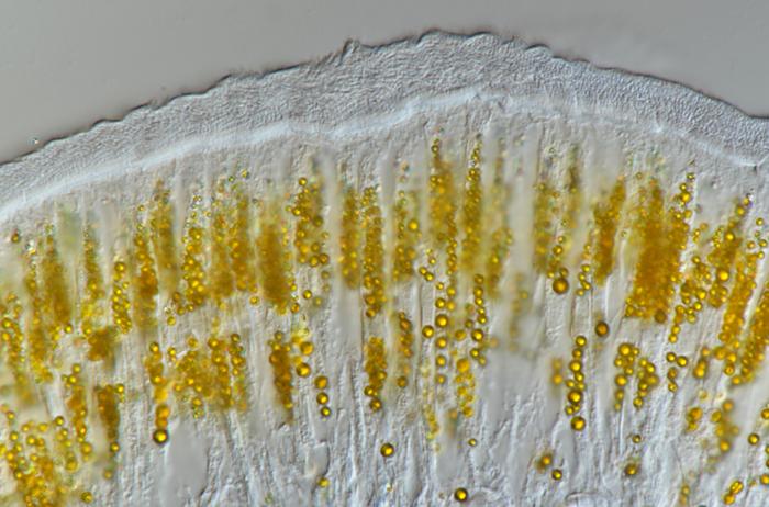 Die gelben Körnchen im Gewebe von Paralvinella hessleri bestehen aus dem Mineral Orpiment und sind Teil seines besonderen Entgiftungsmechanismus. © Wang H, et al., 2025, PLOS Biology, CC-BY 4.0