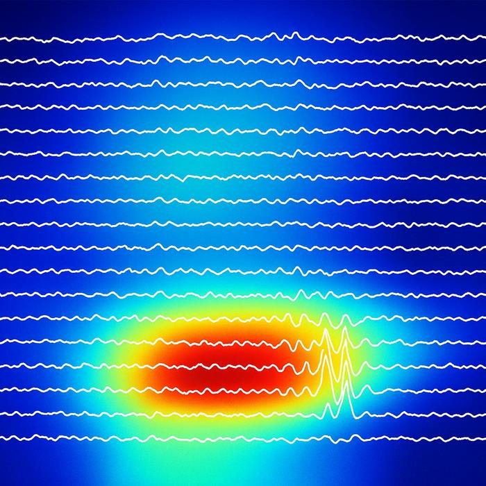 Darstellung der Kopplung zwischen schnellen Gamma- und langsamen Theta-Wellen im Gehirn. Farbige Bereiche zeigen die Stärke der Wechselwirkung, weiße Linien markieren die aufgezeichnete neuronale Aktivität.
