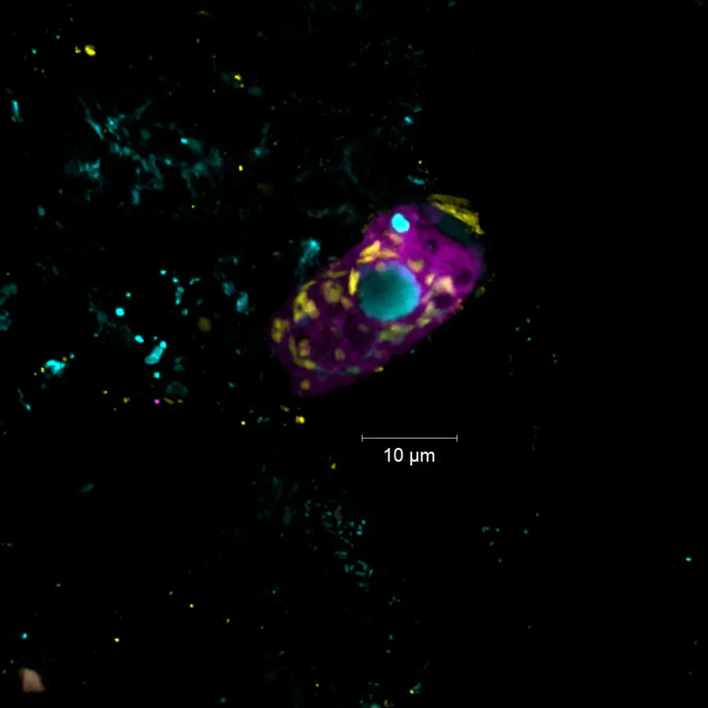 Der Endosymbiont Candidatus Azoamicus mariagerensis und sein Ciliatenwirt unter dem Fluoreszenzmikroskop. Zu sehen sind der Endosymbiont (gelb) und der Ciliat (violett). Der Zellkern des Ciliaten ist mit einem DNA-Farbstoff (blau) angefärbt.