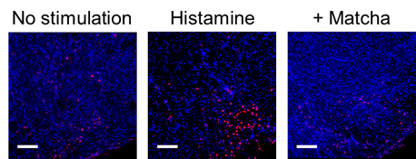 Im Versuch reagierte das Nieszentrum der Mäuse auf Histamin mit erhöhter Aktivität. Nach der Behandlung mit Matcha fiel diese Aktivierung deutlich geringer aus – passend zur beobachteten Abschwächung des Niesreflexes bei Heuschnupfen.
