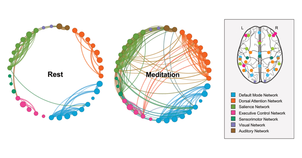Die Abbildung zeigt, wie sich die Verbindungen zwischen verschiedenen Hirnarealen während Ruhe und Meditation verändern.