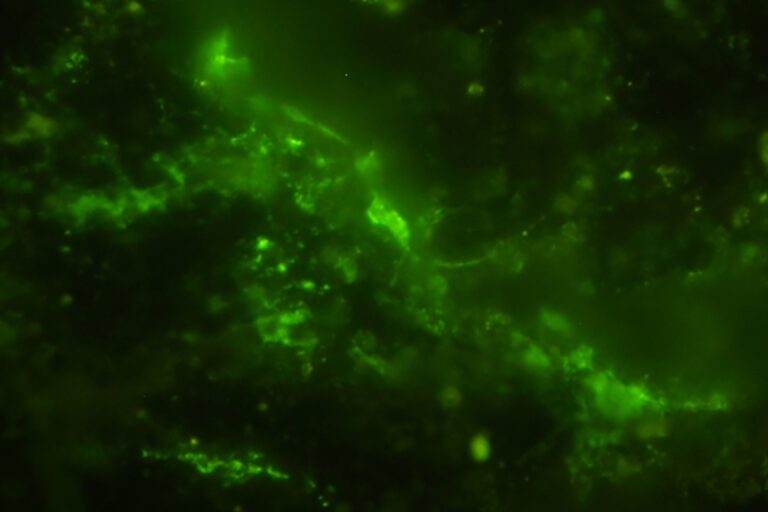 Diese Mikroben hier sind rund 2 Milliarden Jahre alt und damit ein echter Sensationsfund.