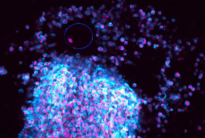 Aufnahme der Eizelle kurz nach dem Eisprung neben dem Follikel. © Christopher Thomas, Tabea Lilian Marx et al./ MPI f. Multidisziplinäre Naturwissenschaften