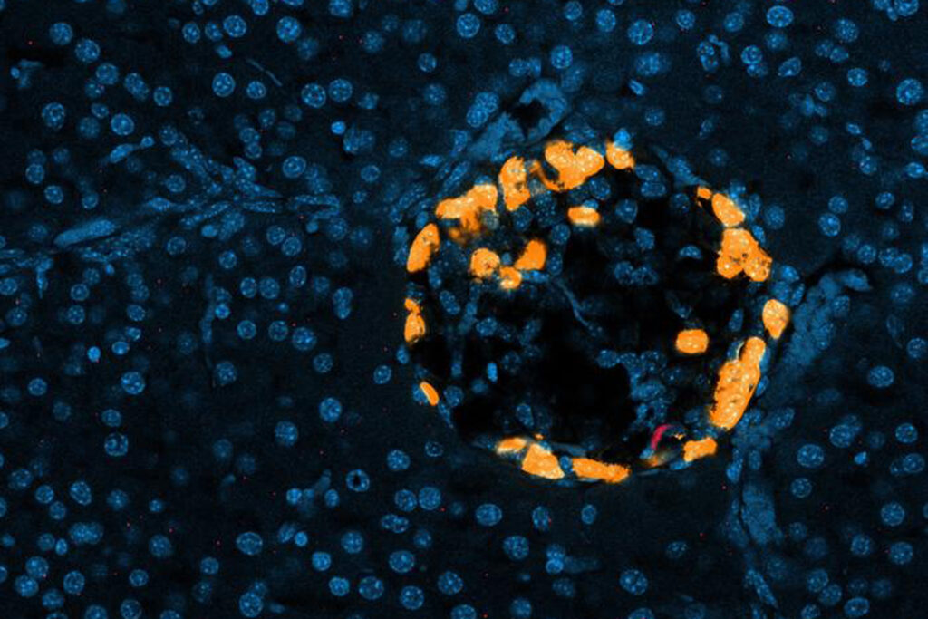 Immunzellen (rot) wandern bei Fasten oder Anstrengung in die Bauchspeicheldrüse und stimulieren Glukagonzellen (orange), Zellkerne sind blau. © Immunophysiology Lab, Champalimaud Foundation