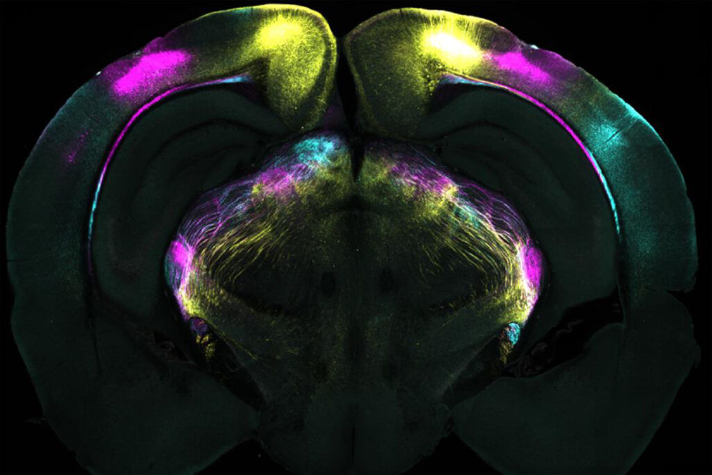 Koronaler Hirnschnitt: Sichtbar sind Nervenbahnen, die visuelle Signale aus der Großhirnrinde zum ventrolateralen Nucleus geniculatus (vLGN) leiten. Diese Verbindungen helfen dem Gehirn, instinktive Angstreaktionen zu unterdrücken. © Sainsbury Wellcome Centre