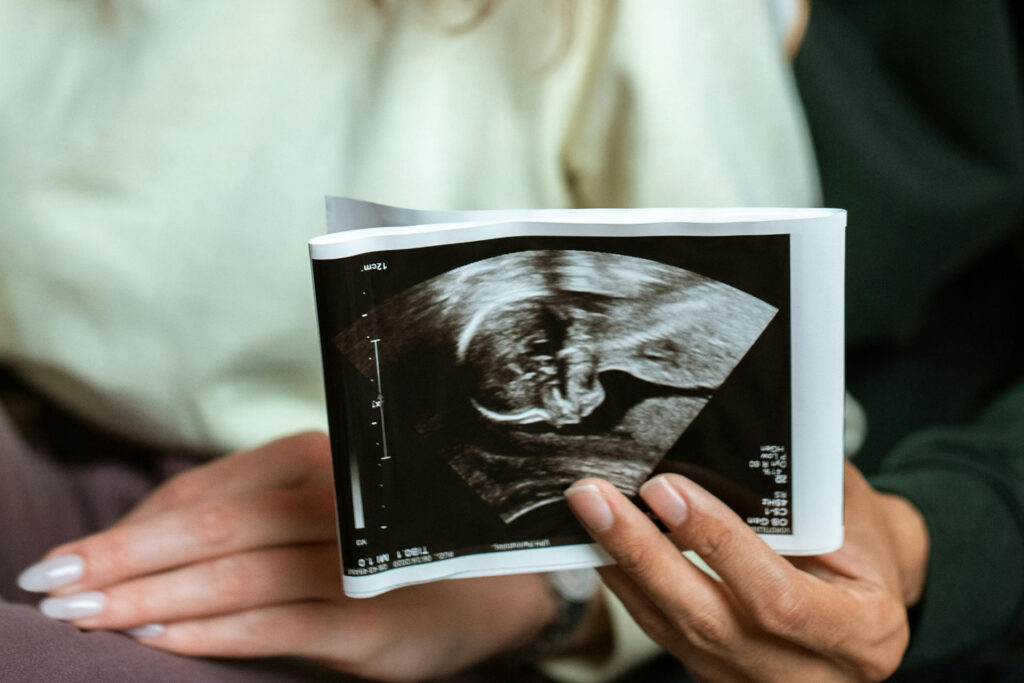 Erstmals im Mutterleib behandelt: Ein Baby mit spinaler Muskelatrophie erhielt noch vor der Geburt ein lebensrettendes Medikament – und bleibt gesund. © Pexels