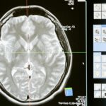 Wissenschaftler haben das Gehirn von Menschen und Schimpansen miteinander vergleichen und bedeutende Erkenntnisse über Alterungsprozesse des Organs gemacht. © Pexels