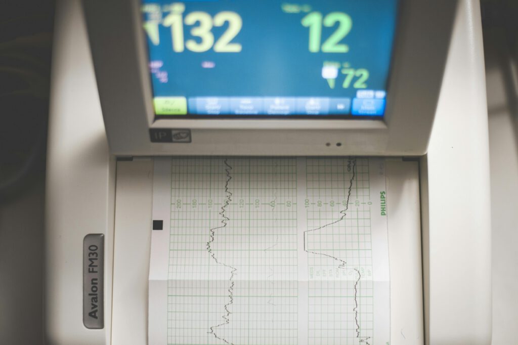 KI erkennt beginnenden Bluthochdruck im EKG