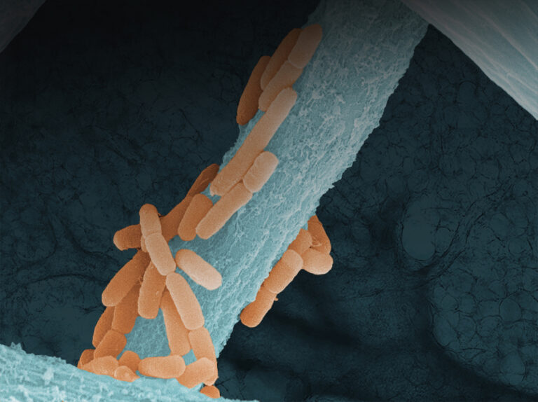 Schimmelpilz in der Lunge bringt ganzen Körper aus dem Takt.