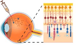 Über den Glaskörper gelangen winzige Goldpartikel gezielt an die Netzhaut, wo sie bestimmte Nervenzellen aktivieren. © Nie et al., ACS Nano, 2025