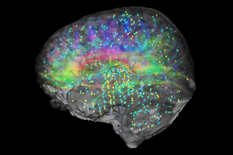 Studie zeigt, wo das Bewusstsein entsteht