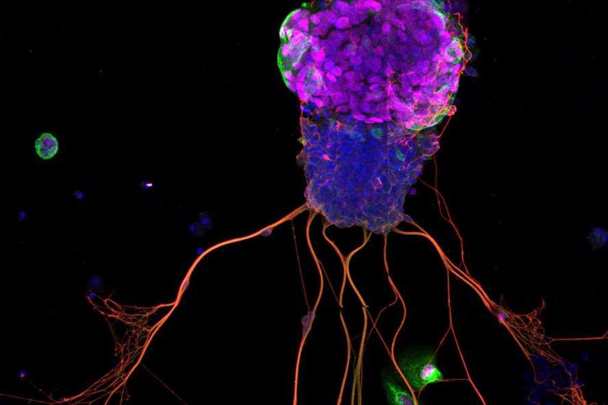 Ein repräsentatives Bild eines Organoids, gezüchtet von Brian Lin und seinem Team – laut den Forschern war es tatsächlich das erste, das sie je gesehen haben. © Tuft University