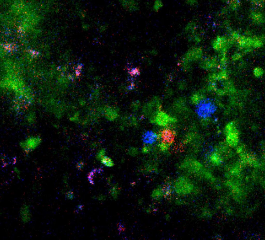 Das Toleranz-Team: Lymphgewebe einer Maus mit einem Zellcluster aus immunaktiven Zellen, die orale Toleranz auslösen – markiert in Grün, Rot und Blau. Der Zellverbund ermöglicht die Kommunikation zwischen den beteiligten Zelltypen. © Weizmann Institute