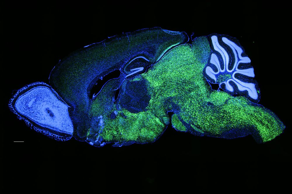 Verteilung des Sprachgens NOVA1 im Mausgehirn: grün markiert ist NOVA1, blau die Zellkerne. © Darnell-Labor