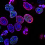 Universeller Krebs-Impfstoff? mRNA aktiviert das Immunsystem.