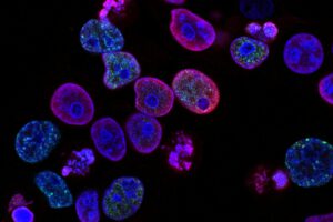Universeller Krebs-Impfstoff? mRNA aktiviert das Immunsystem.