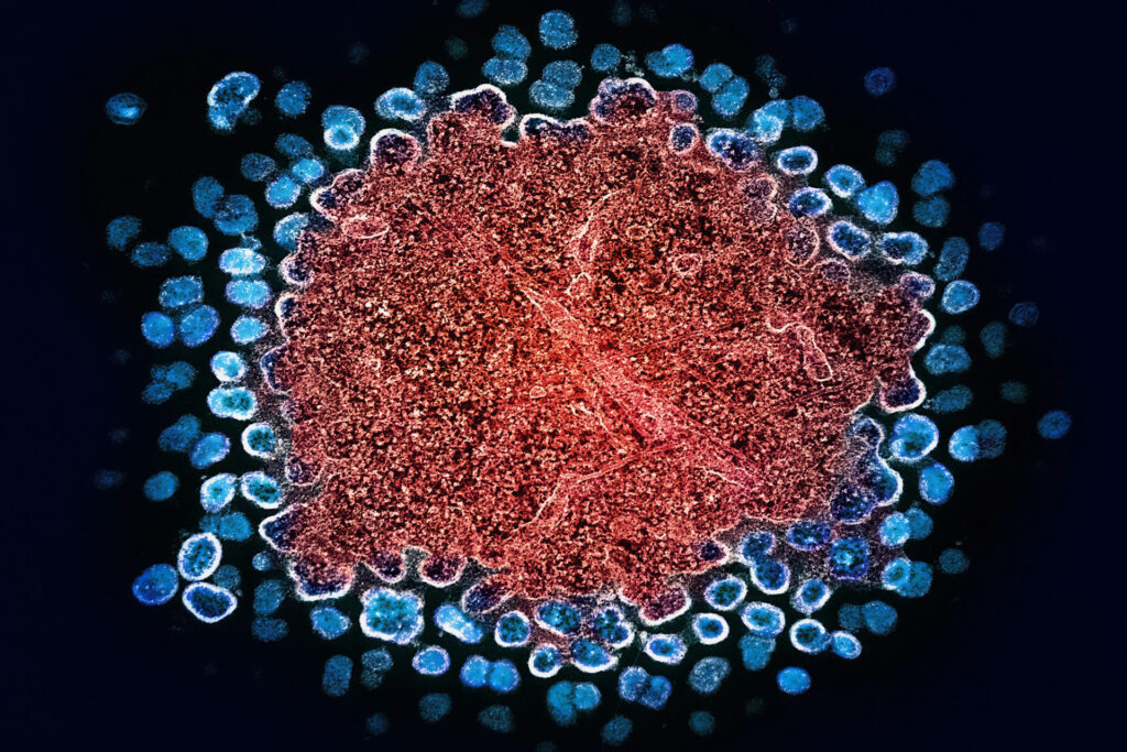 HIV nutzt Zelltransport flexibel – Therapien in Gefahr