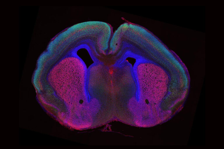 Forscher entschlüsseln erstmals die Entstehung von Hirnfalten
