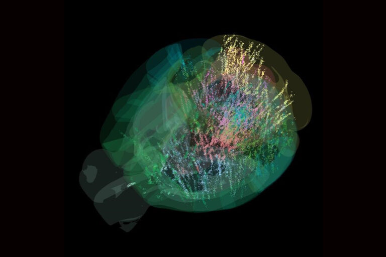 Gehirnaktivitätskarte zeigt, wie unser Gehirn Entscheidungen trifft