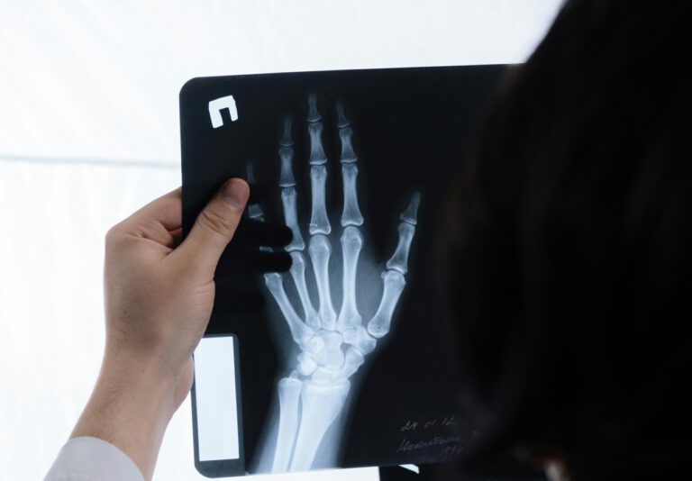 Knochen-Kleber aus Muscheln: Brüche heilen in Minuten