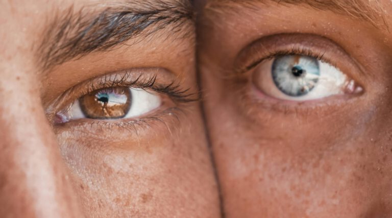 Das steckt hinter den unterschiedlichen Augenfarben