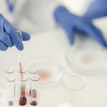 Bluttest erkennt Tumor-DNA und findet Krebs, den Ärzte übersehen