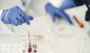 Bluttest erkennt Tumor-DNA und findet Krebs, den Ärzte übersehen