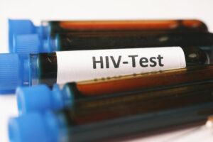 HIV fast verschwunden: Antikörper aus Köln sorgt für Aufsehen