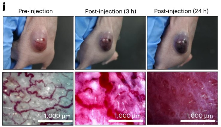 Live-Aufnahme zeigt, wie die Bakterien-Therapie nach der Injektion Tumorgefäße zerstört und den Krebs im Mausmodell zum Absterben bringt. © Studie