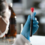 Herzgesundheit: Dieser Blutwert warnt schon früh vor Demenzrisiko