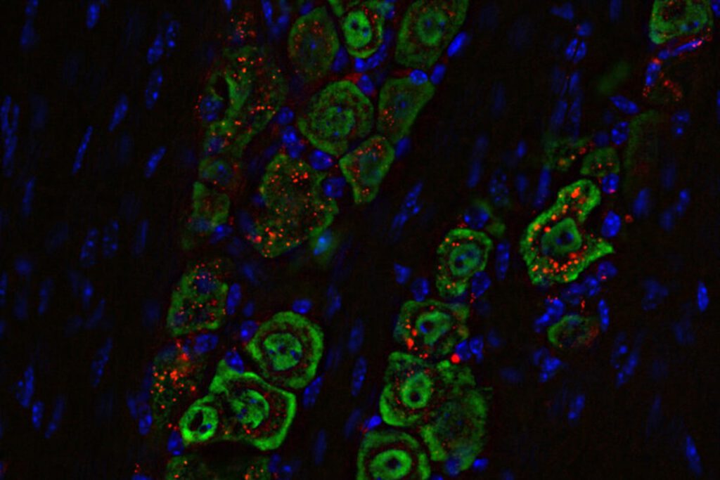 Nasentropfen gegen Hirntumor – Neuer Weg ins Gehirn entdeckt
