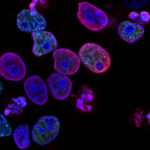 Krebszellen