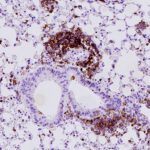 Die Abbildung zeigt Lungenalveolargewebe aus einem Mausmodell für kleinzelligen Lungenkrebs mit braun markierten Immunzellen