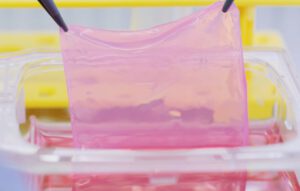 Aus zwei Hautschichten wird neue, lebende Haut: Durch die Kombination von Ober- und Lederhaut bleibt der gezüchtete Hautersatz elastisch und kann sich dem Körper der Patienten anpassen.