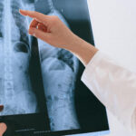 Eine Ärztin begutachtet Röntgenaufnahmen der Wirbelsäule