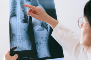 Eine Ärztin begutachtet Röntgenaufnahmen der Wirbelsäule