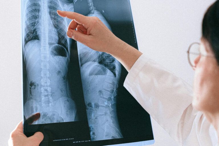Eine Ärztin begutachtet Röntgenaufnahmen der Wirbelsäule