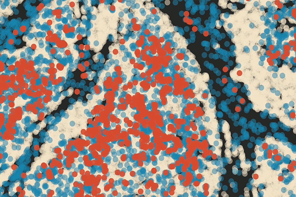 Tumor- und Krebszellen