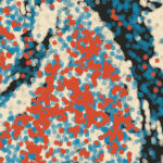 Tumor- und Krebszellen