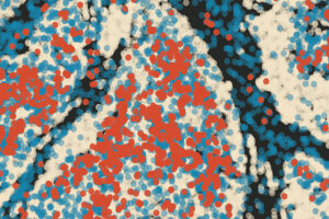 Tumor- und Krebszellen