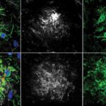 PTP1B als neuer Ansatz gegen Gedächtnisverlust: Im Alzheimer-Mausmodell aktiviert seine Hemmung die Immunzellen (grün) und verringert Amyloid-Plaques (grau).