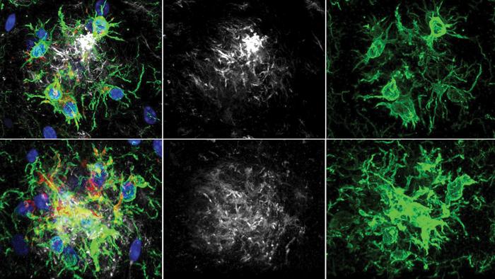 PTP1B als neuer Ansatz gegen Gedächtnisverlust: Im Alzheimer-Mausmodell aktiviert seine Hemmung die Immunzellen (grün) und verringert Amyloid-Plaques (grau).