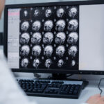 Blick auf Hirn-Scans