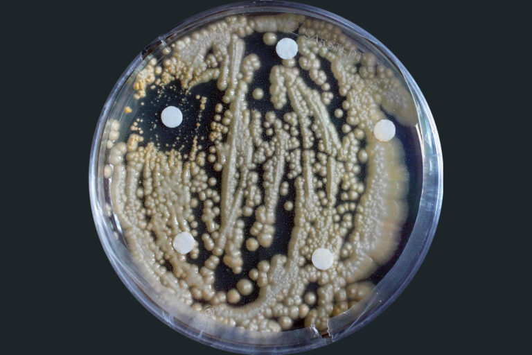 Mikroskopaufnahme von einem Pilz in einer Petrischale