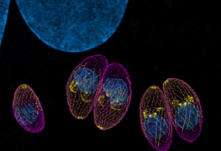 Toxoplasma gondii unter dem Mikroskop