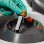 Alzheimer: Zufallsfund im Blut könnte Grundlage für neuen Test werden