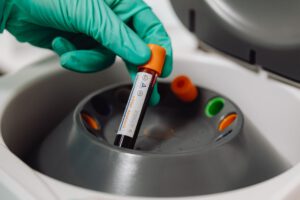Das körpereigene Molekül HAEE kommt im Blut von Alzheimerpatienten in deutlich geringerer Konzentration vor. Forscher prüfen, ob sich daraus ein neuer Bluttest entwickeln lässt. © Pexels