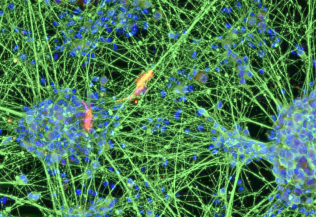 Aus Blutzellen entstehen Nervenzellen: Bonner Wissenschaftler konnten dabei das molekulare Zellalter um Jahrzehnte zurücksetzen. © Brüstle Research Group / Universität Bonn